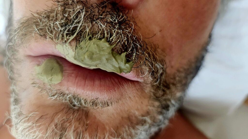 Herpes labiale - Labbra