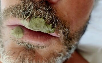 Herpes labiale. Rimedio con argilla verde